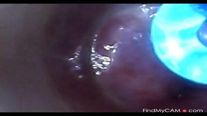 Test Tube Cock Endoscope Pov Urethral Insertion Ball Rod free video